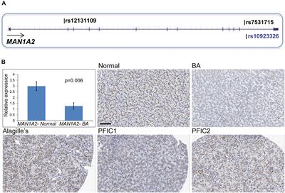 Biliary-Atresia-Associated Mannosidase-1-Alpha-2 Gene Regulates Biliary and Ciliary Morphogenesis and Laterality